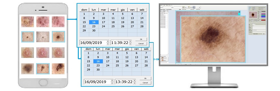 Videodermatoscopi e software