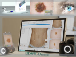 Software Dermatoscopia